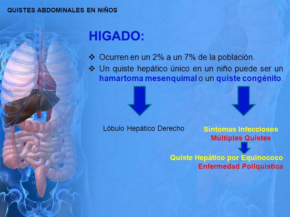 Quiste hepatico sintomas